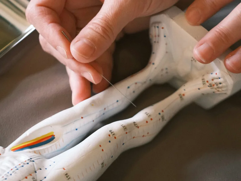 Acupuncture at True North Chiropractic Center in Thief River Falls