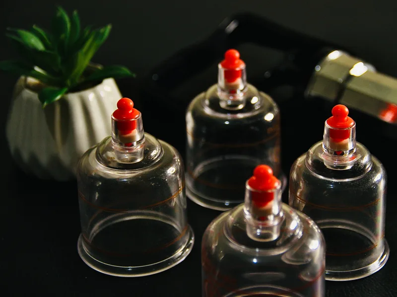How Cupping Therapy works at True North Chiropractic Center