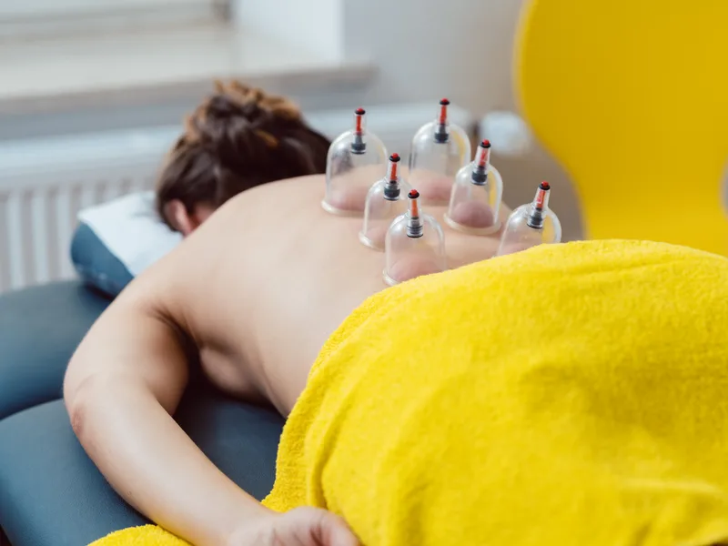 Cupping Therapy at True North Chiropractic Center in Thief River Falls