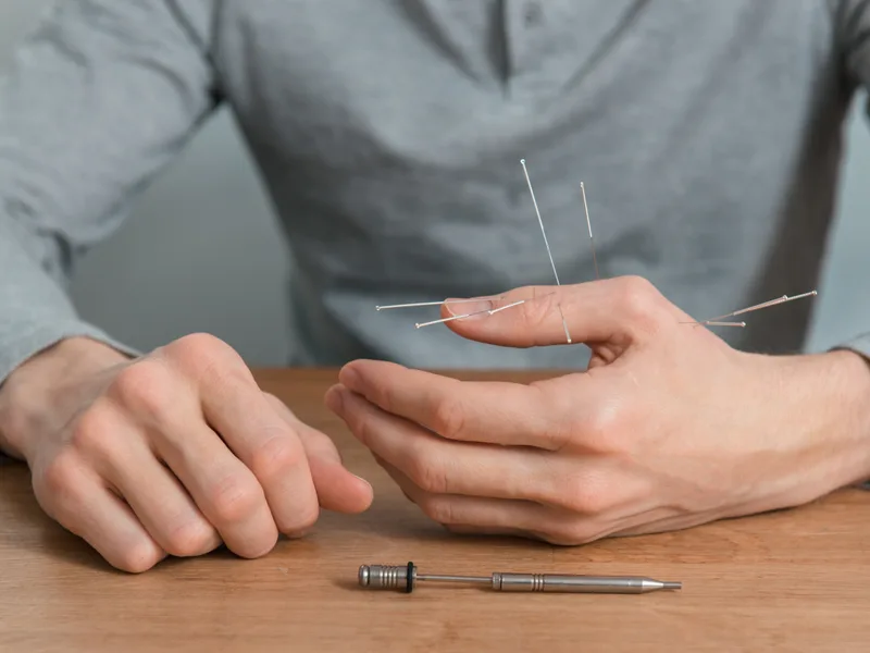 Dry Needling at True North Chiropractic Center in Thief River Falls