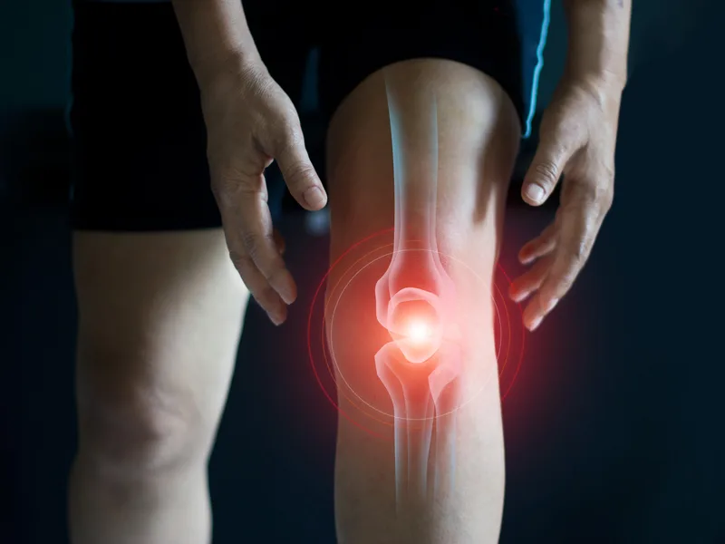 How True North Chiropractic Center treats arthritis in Thief River Falls